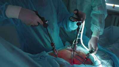 Best Doctor for Gallbladder Stone Surgery in Kolkata - West Bengal - Kolkata ID1617469