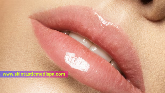 Enhance Your Smile with Lip Filler Treatments - California - Riverside ID1545454