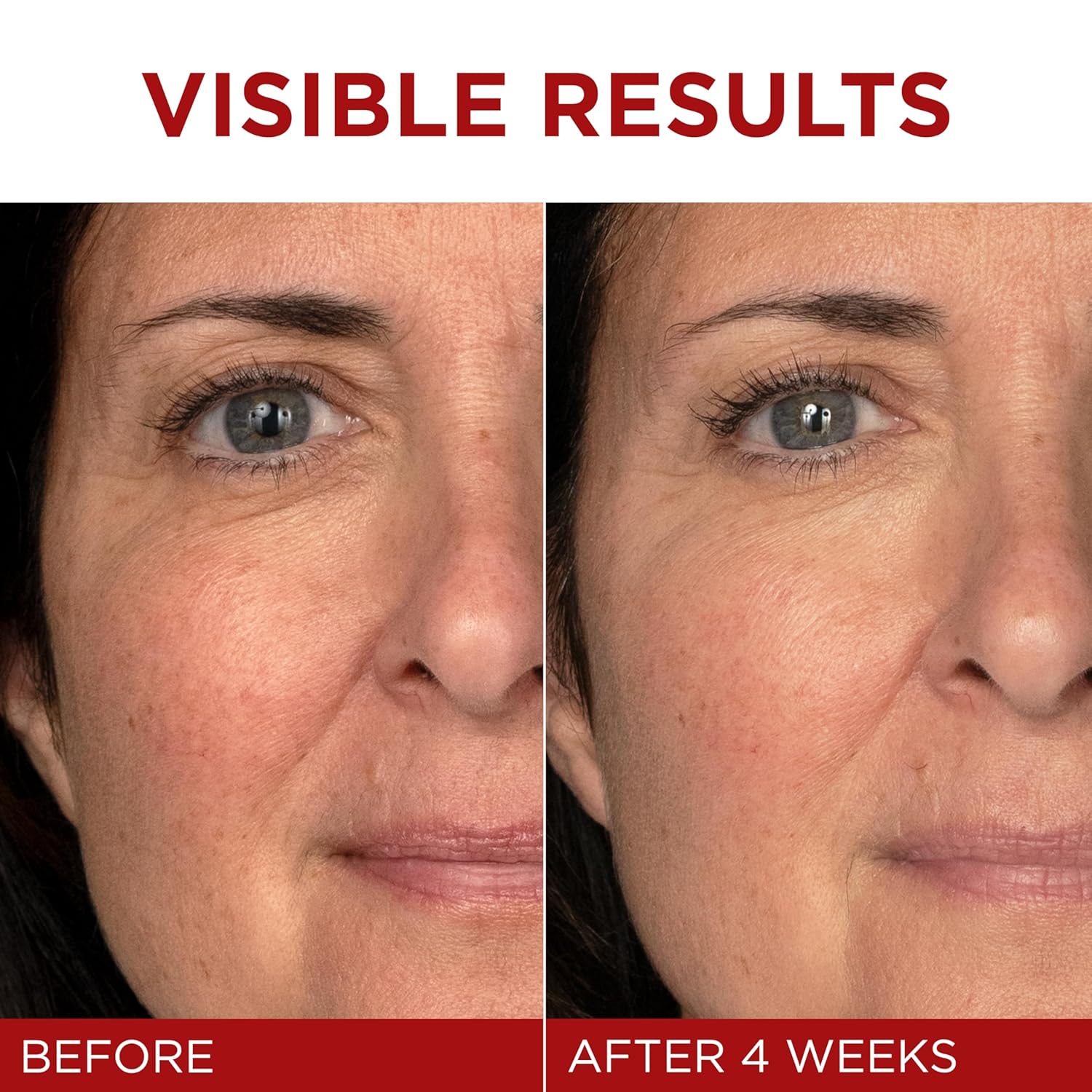 LOreal Paris Revitalift Triple Power AntiAging Face Review - New York - New York ID1595706 2