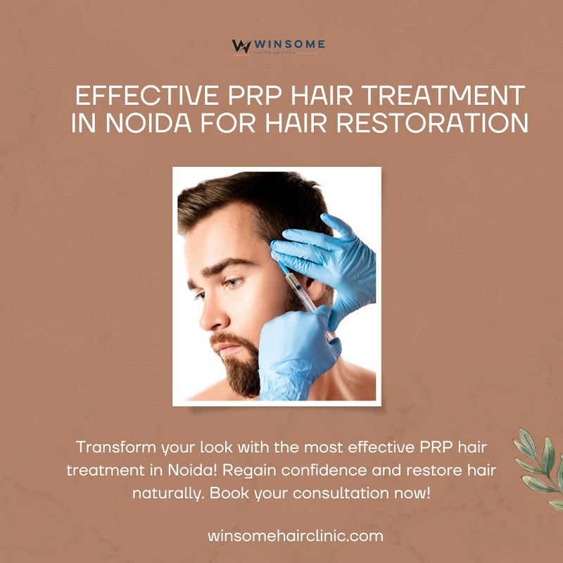 Effective PRP Hair Treatment In Noida For Hair Restoration - Uttar Pradesh - Noida ID1594739