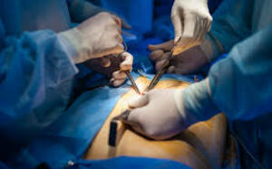 Advanced Gallstone Treatment at Genesis Hospital Kolkata - West Bengal - Kolkata ID1599350