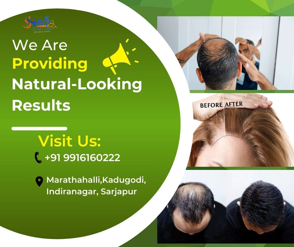 NaturalLooking Results Hair Fixing Services Available Sar - Karnataka - Bangalore ID1549068