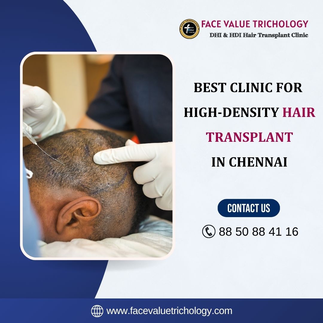 High Density Hair Transplant Clinic in Chennai - Tamil Nadu - Chennai ID1607900
