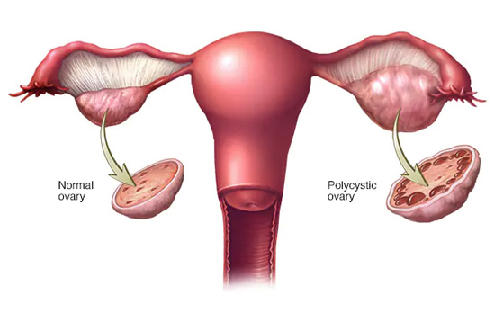  Best Fertility Hospitals in Bangalore  Best doctor for inf - Karnataka - Bangalore ID1591564