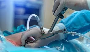 Dr Purnendu Roy  Expert in Minimally Invasive Gallbladde - West Bengal - Kolkata ID1601999