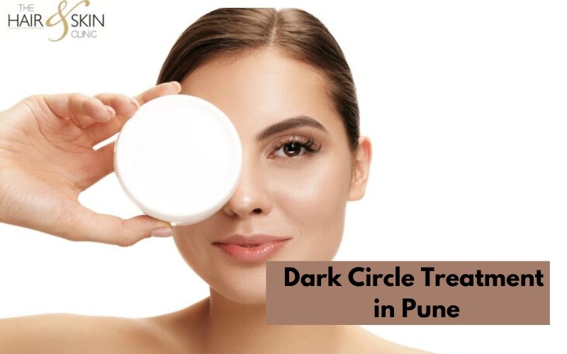 Dark Circle Treatment in Pune  Hair  Skin Clinic - Maharashtra - Pune ID1562256