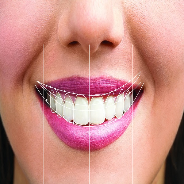 Best Smile designing clinic in Dubai UAE - District of Columbia - Washington DC ID1593894