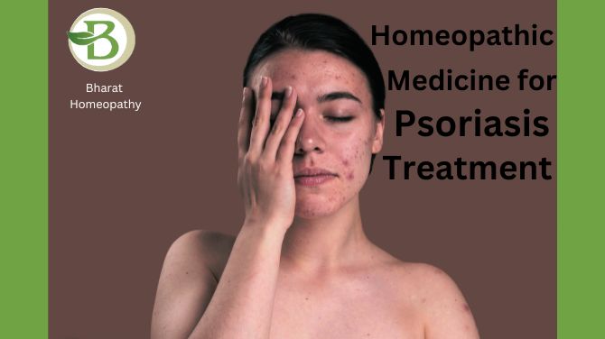 Best homeopathic remedies for psoriasis - Haryana - Gurgaon ID1538111