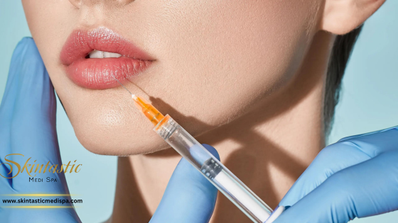 Experience the Natural Beauty with Premium Lip Filler Treatm - California - Riverside ID1554275