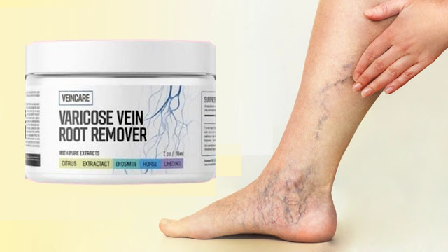 Can Veincare Cream vein root remover reduce spider veins? - California - Los Angeles ID1612209