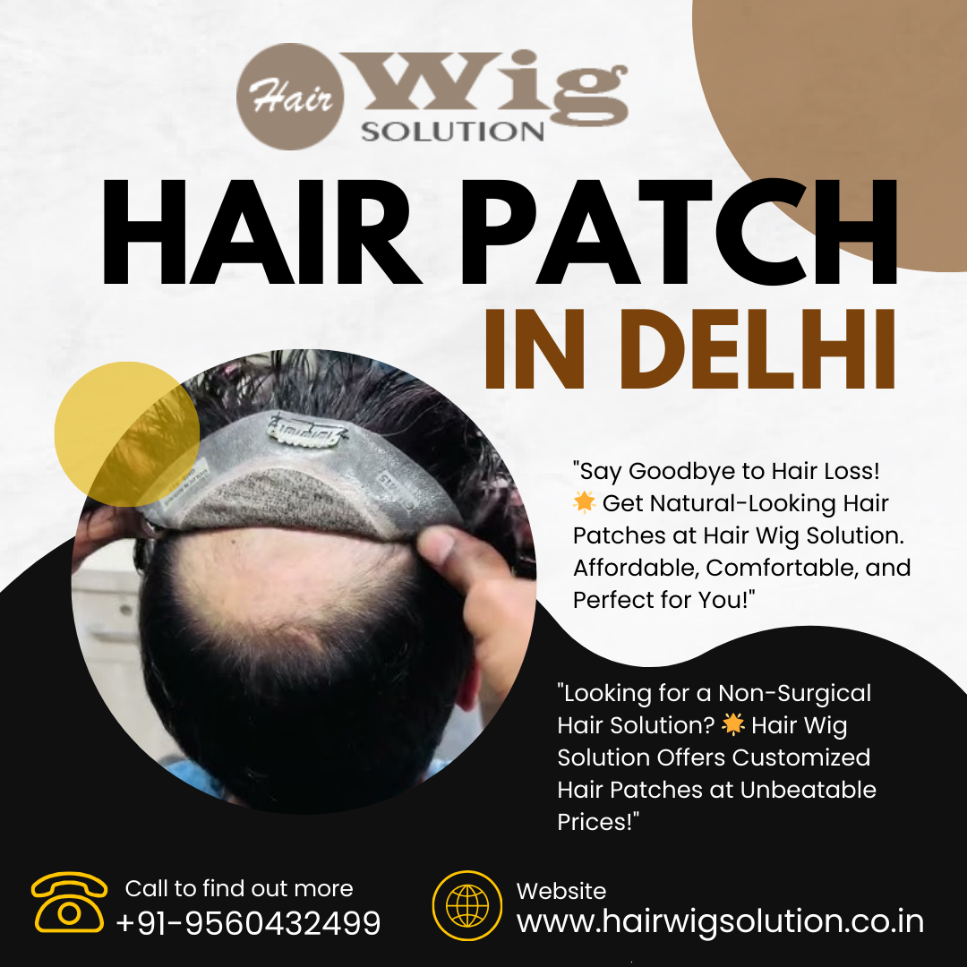 Affordable Hair Patch in Delhi  Hair Wig Solution - Delhi - Delhi ID1592128