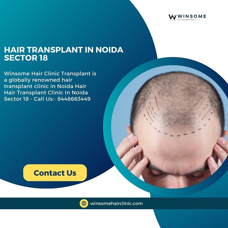 Hair Transplant in Noida Sector 18 - Uttar Pradesh - Noida ID1544056