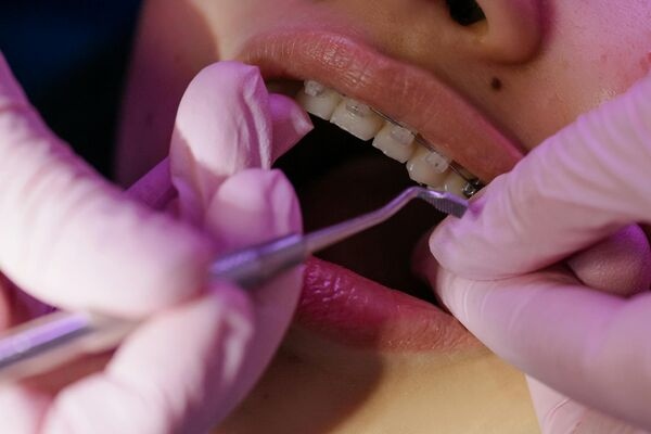 Affordable Dental Braces in Newtown Kolkata - West Bengal - Kolkata ID1609410