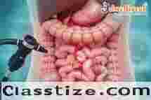 Advanced Surgical Solutions for Stomach & Colon in Kolkata