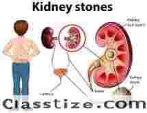 Kidney Stone Treatment in Noida  Dr. Lok Prakash Choudhary
