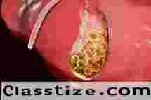 Expert Gallbladder Stone Surgery Doctor in Kolkata