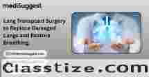Lung Transplant Procedure