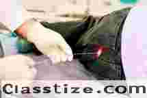 Laser Proctology Expertise by Dr. Sabyasachi Goswami