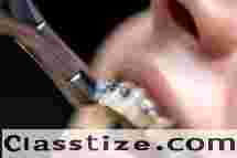 Trusted Orthodontic Specialists in Maricopa for Healthy, Beautiful Smiles