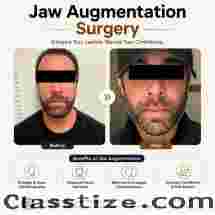Jaw Augmentation Near Me | Jaw Augmentation Surgery Specialists