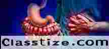 Inflammatory Bowel Disease (IBD) Treatment Ahmedabad