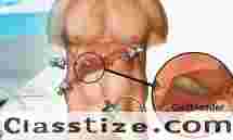 Affordable Gallbladder Stone Surgery Packages in Kolkata