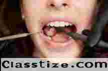 Root Canal Treatment in Newtown by Expert Dentist