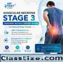 Avascular Necrosis Stage 3 Treatment without Surgery in India – HipXpert
