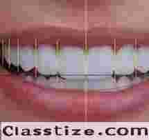 Aesthetic Dentistry Clinic in Chetla for Smile Care   
