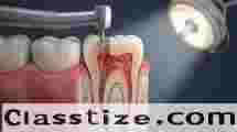 Save Your Natural Teeth with Expert Root Canal Care  