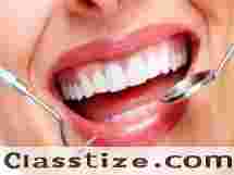 Best Root Canal Treatment in Chetla for Tooth Relief