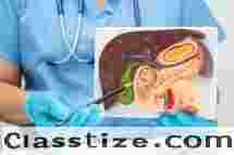 Trusted Specialist for Gallbladder Surgery in Kolkata  