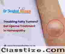  Troubling Fatty Tumors? Get Lipoma Treatment in Homeopathy