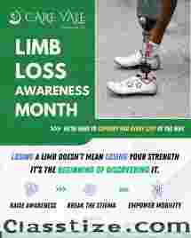 Best Artificial Leg  in Hyderabad | CareVale Prosthetics