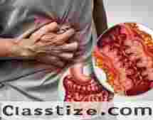 Dr. Jigar Patel for Advanced IBD Treatment in Ahmedabad