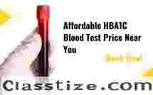 HbA1c Blood Test: Purpose, Normal Range & Price Details