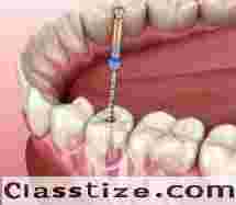 Advanced Root Canal Treatment Clinic in Chetla  