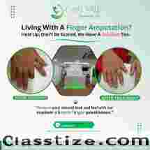 Free Artificial leg In Hyderabad | CareVale Prosthetics