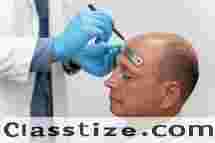 Best Hair Transplant Clinic in Bilaspur | Natural & Lasting Results