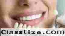 Aesthetic Dentistry Clinic in Chetla for Perfect Smile