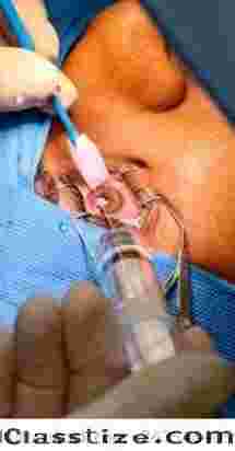 Cornea & Refractive Treatment in Andul for Clear Vision