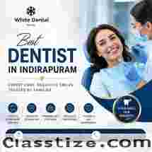 Best Dentist in Indirapuram for Complete Oral Healthcare