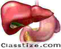 Advanced Gall Stone Specialist Specialist in Kolkata  
