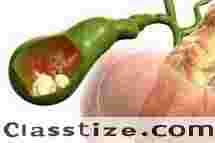 Dr. Purnendu Roy – Best Doctor for Gallbladder Stone Surgery in Kolkata