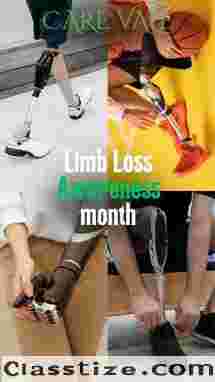 Best Prosthetic Leg Clinic in Hyderabad | CareVale Prosthetics