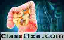 Dr. Purnendu Roy for Stomach and Colonic Surgeries Kolkata