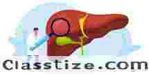 Where Is The Best Fatty Liver Treatment in India?