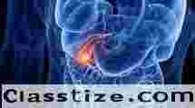 Dr. Nitin Bhel for Gallbladder Cancer Treatment in Ludhiana