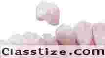 Dental Crowns in San Antonio, TX
