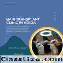 Hair Transplant Clinic In Noida
